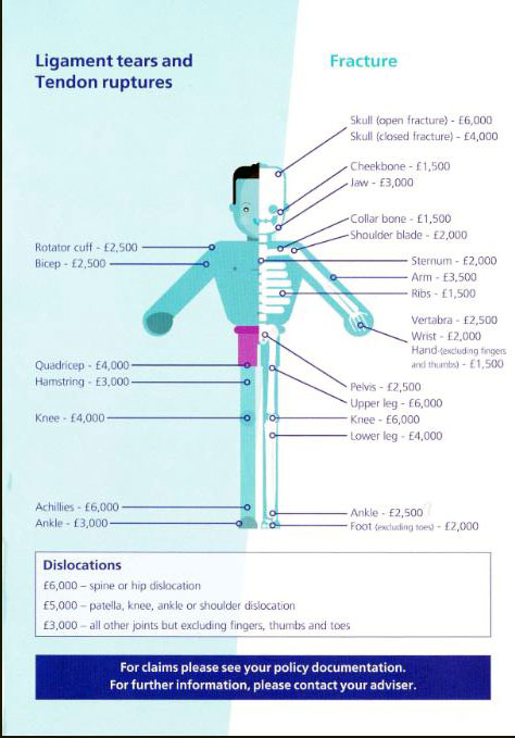 UK rider protection cover: broken bones & dislocations | NEWS
